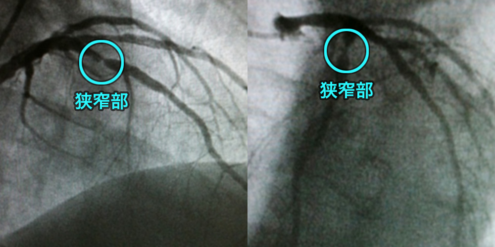 血管造影検査：さいとうハートクリニック